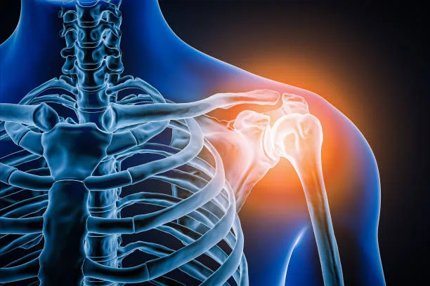 Shoulder repair
